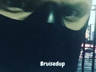 Bruisedup