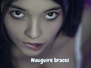 Nauguire_braces